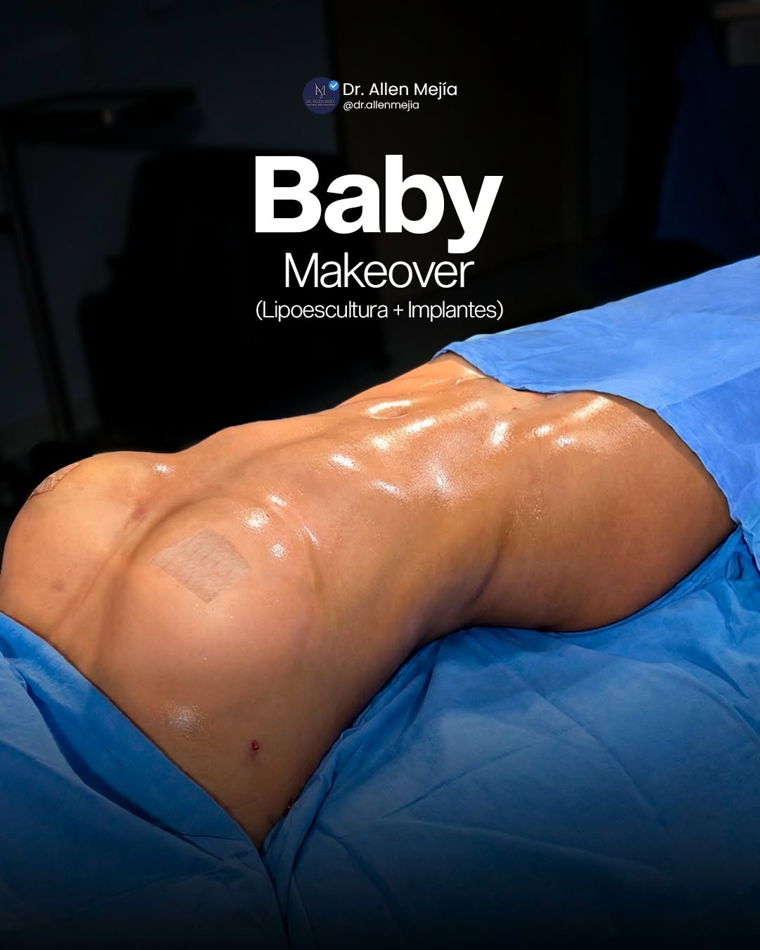 Resultado baby makeover - vista protegida